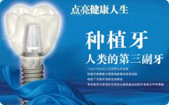 <b>安顺市平坝县“一颗种植牙”大概需要多少钱？</b>