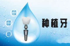 <b>植得安顺平坝十字乡爱美者追求的“微创种植牙</b>