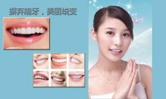 <b>平坝成人“龅牙矫正”需要多少钱？</b>